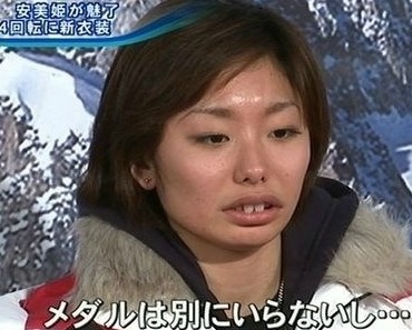일본인 치아에 대한 이미지 검색결과