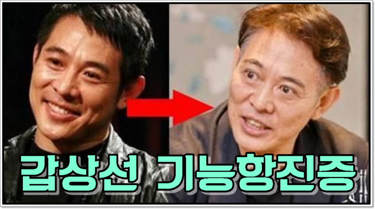 솔지 갑상선 기능항진증 확진 안구돌출 활동중단 네이버 블로그
