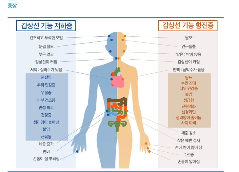 갑상선 기능항진증 여러 다양한 증상 네이버 블로그